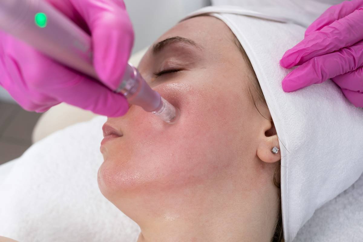 How to Use Facial Device for Real Anti-Aging Results (Without Wasting $300)